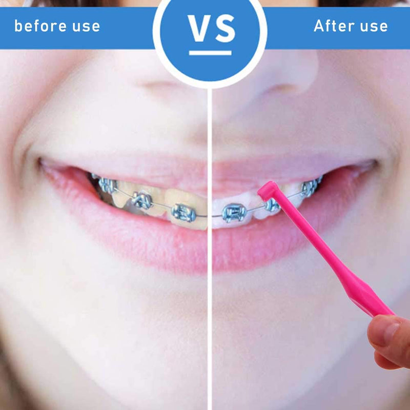 10 PCS Interspace Toothbrushes Soft Interdental Toothbrushes Gum Interdental Teeth Brushes Orthodontic Toothbrushes Dental Gap Brushes Single Tufted Brush Slim Interspace Brush For Braces Bridges 10pcs - NewNest Australia