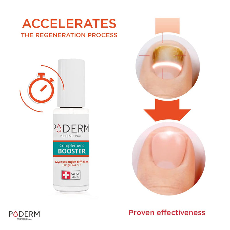 PODERM - FUNGAL NAIL INFECTION TREATMENT BOOSTER for fungal nail infections that are difficult to treat - Halves the treatment time - Professional foot/hand treatment - Quick & easy - Swiss Made - NewNest Australia