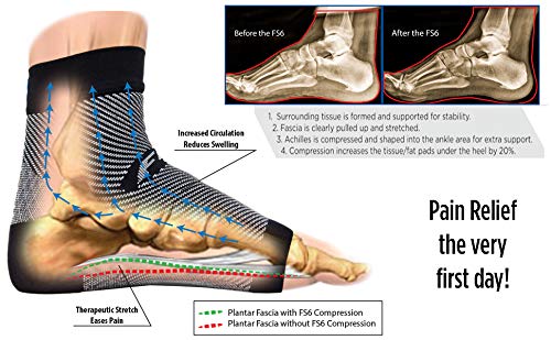 Orthosleeve Fs6 Foot Bandage Exclusive Compression Zone Technology With 6 Zones, Plantar Fasciitis, Heel Pain & Relief From Swelling | 24 Hour Comfort | 1 Pair, Black - Size M - NewNest Australia