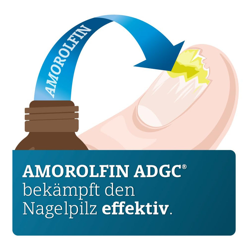 AMOROLFIN ADGC 50 mg/ml 5ml - nail polish containing active ingredients for the effective treatment of nail fungus - set with 30 disposable darts, alcohol swabs and 10 spatulas - transparent & waterproof - NewNest Australia