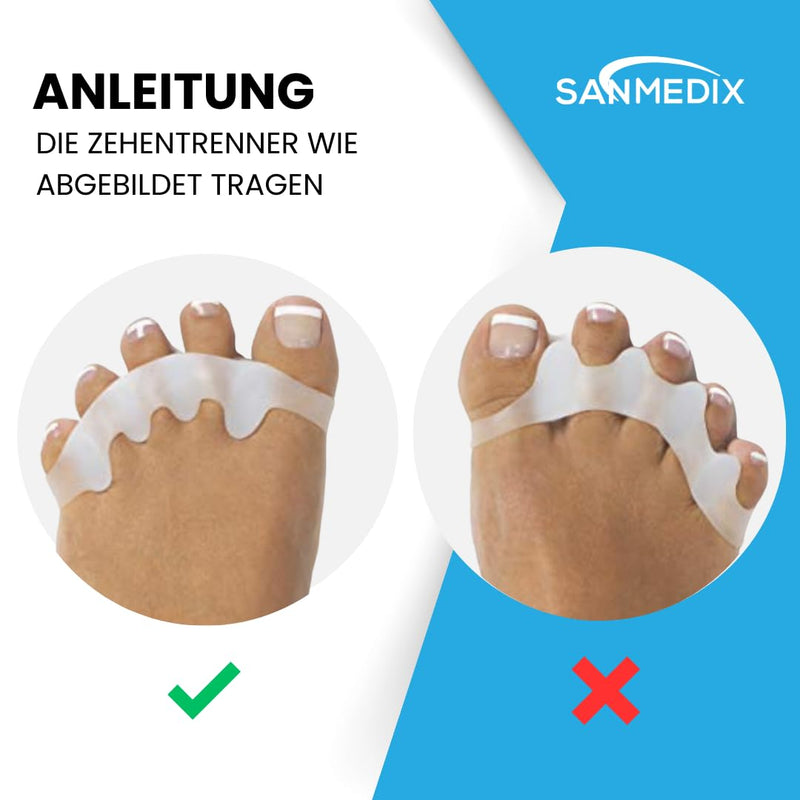 Sanmedix toe separators for all toes - 3 pairs / 6 pieces. Silicone toe separators for men and women - toe extension correction set against hallux valgus, bunions, hammer toes - NewNest Australia
