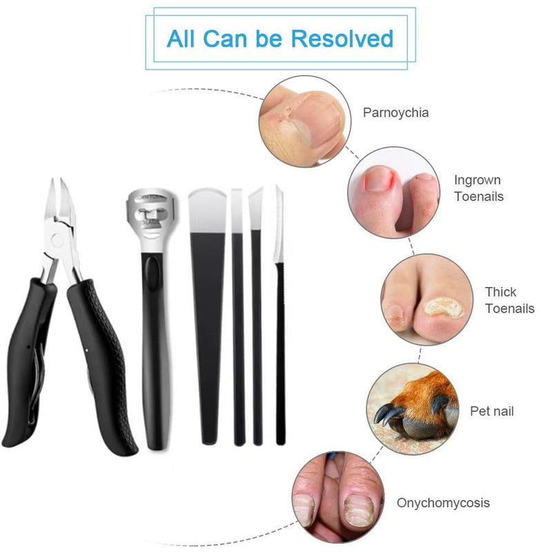 Pedicure Knife Toenail Pliers Kits, Professional Callus Slicer Blades Made Of Stainless Steel Callus Remover, Foot Scraper Dead Skin Foot File Rasp For Scalpel Foot Care Pedicure Foot Care Tools - NewNest Australia