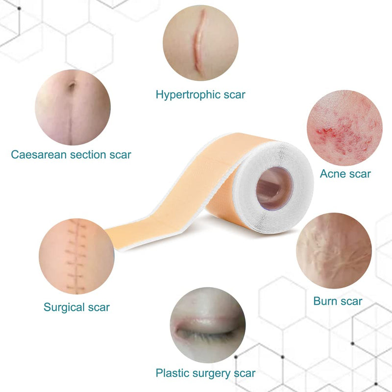 SHEEYOON Silicone Scar Sheets, Silicon Scar Tape Roll，Medical Grade Silicone Scar Removal Sheets, Soften Flatten Fade Scars from Surgery, C-Section, Keloid, Burn, Injury 1.6X120 Inch - NewNest Australia