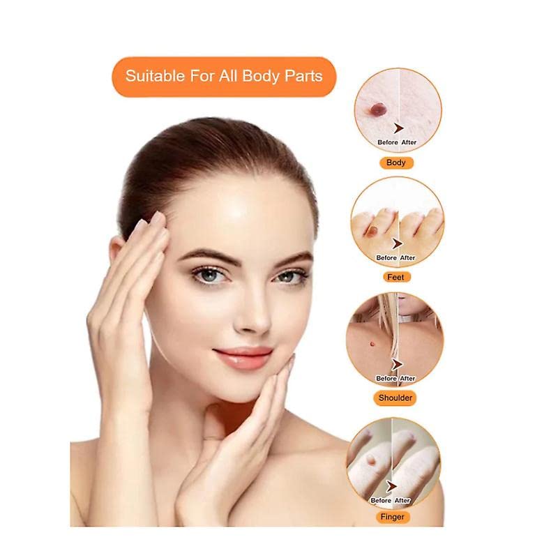 Mole Removal Skin Tag Removal Micro Band Skin Tag Removal Kit Face Body Care Painless and Safe 2 in 1 Professional Mole Wart Remover., Orange - NewNest Australia
