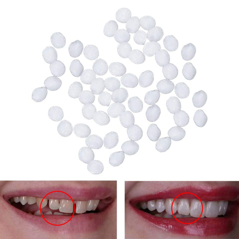 Healifty Thermal Filling Beads Temporary Tooth Beads Dental Filling Materials for Missing Teeth and Broken Tooth Repair Replacements Materials (White) - NewNest Australia