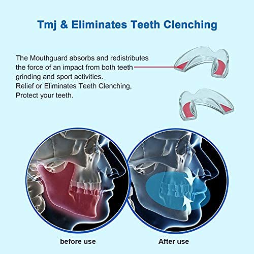 EastermCare Children's Mouth Guard for Teeth Grinding, 4 Pieces Bite Guard + Mouth Guard Case, Eliminates Grinding Bruxism, Teeth Whitening and Sports, Moldable Bite Guard for Children (5-10 Years Old Children) - NewNest Australia