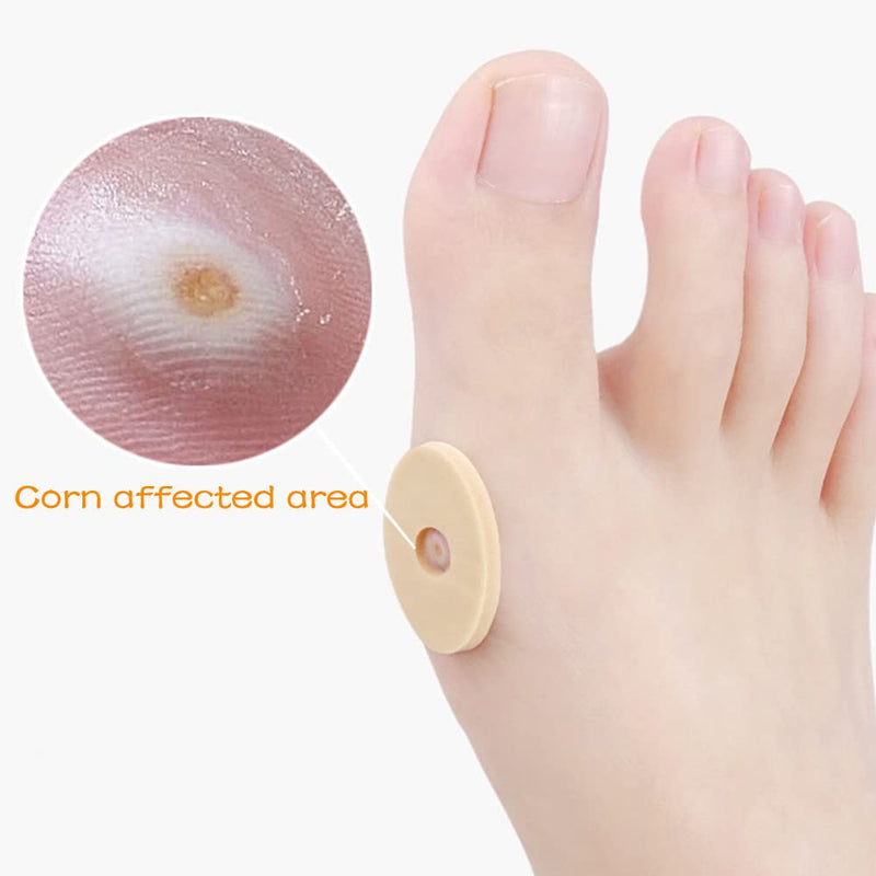 90 Pcs Corn Pillows Soft Latex Foam Self Adhesive Callus Pads Callus Pad for Foot Toes Calluses Anti Friction Reduce Foot Heel Pain 3 Models - NewNest Australia