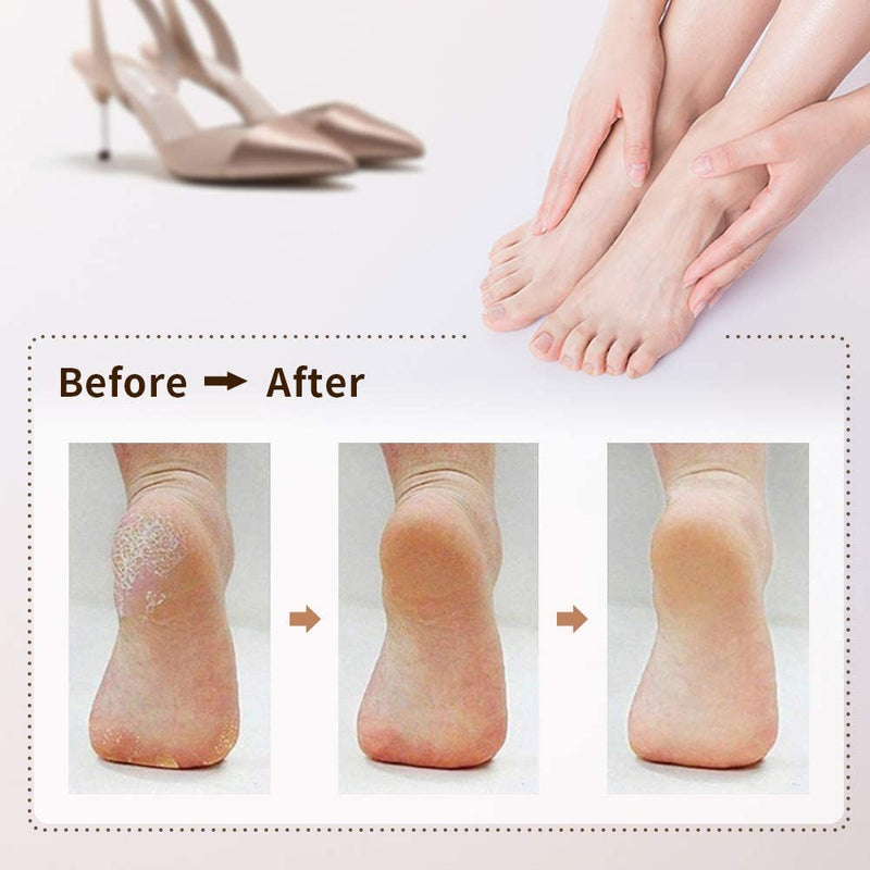 AOYU 8PCS Replacement Rollers Heads Refills for Scholl Velvet Smooth Electric Foot File Roller Refills Pumice Stone for Feet Hard Skin Pedi Roller for Scholl Pedicure Hard Skin Remover - NewNest Australia