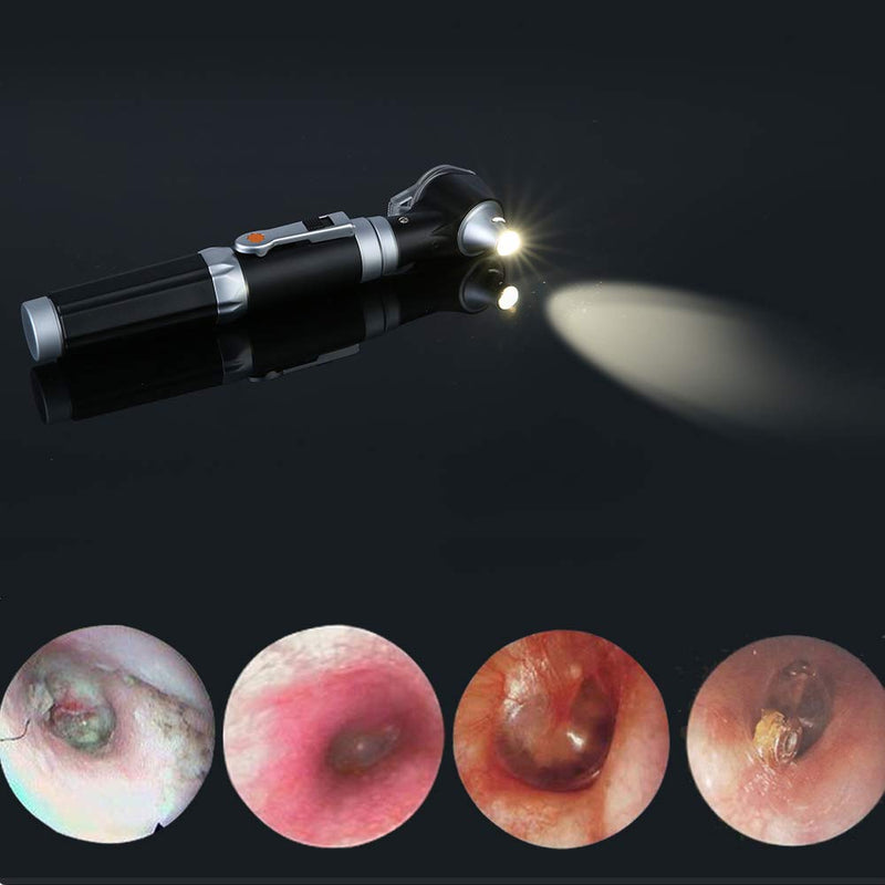 Bysameyee Mini Otoscope Magnification Diagnostic Otoscope With Led Light Direct Light Instrument For Healthy Ears For Doctors Nurses Adults Kids Baby Older Pets Animals - NewNest Australia