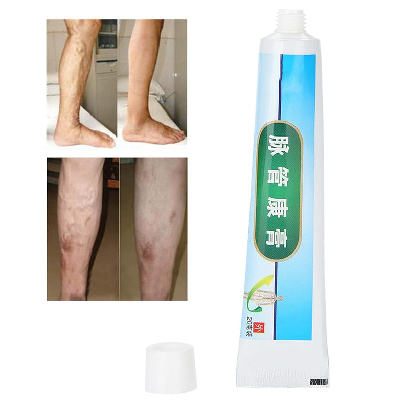 Varicose veins leg cream, anti phlebitis vein care The appearance of Kang foot spider veins with organic ingredients external ointment - NewNest Australia