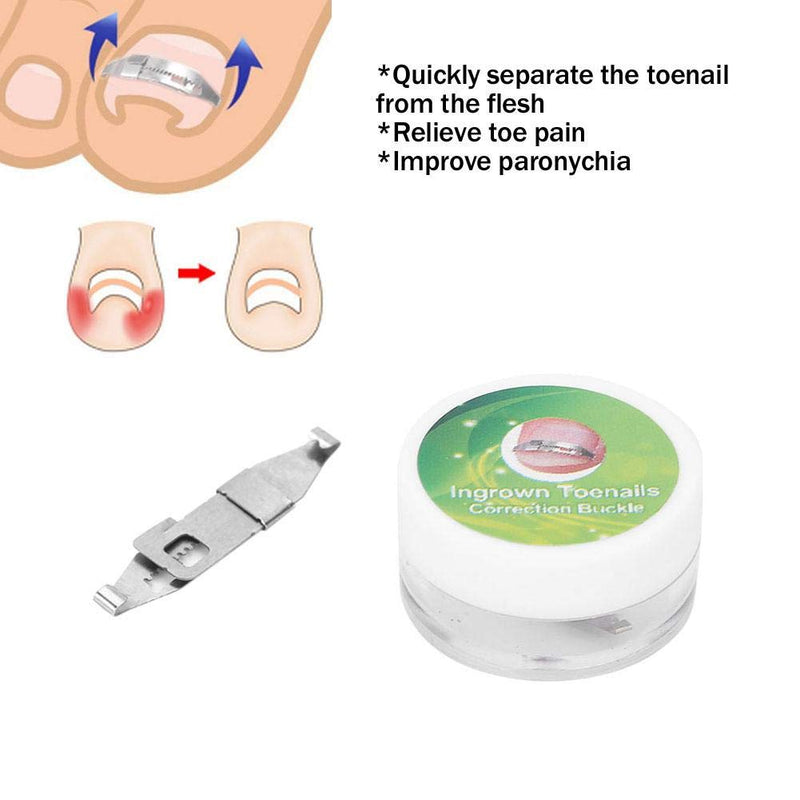 3pcs Ingrown Toenail Tools, Stainless Steel Ingrown Toenail Corrector Pain Relief Paronychia Treatment Correcting Tool for Ingrown Toe Nails Curve Correct, Correct Toes - NewNest Australia