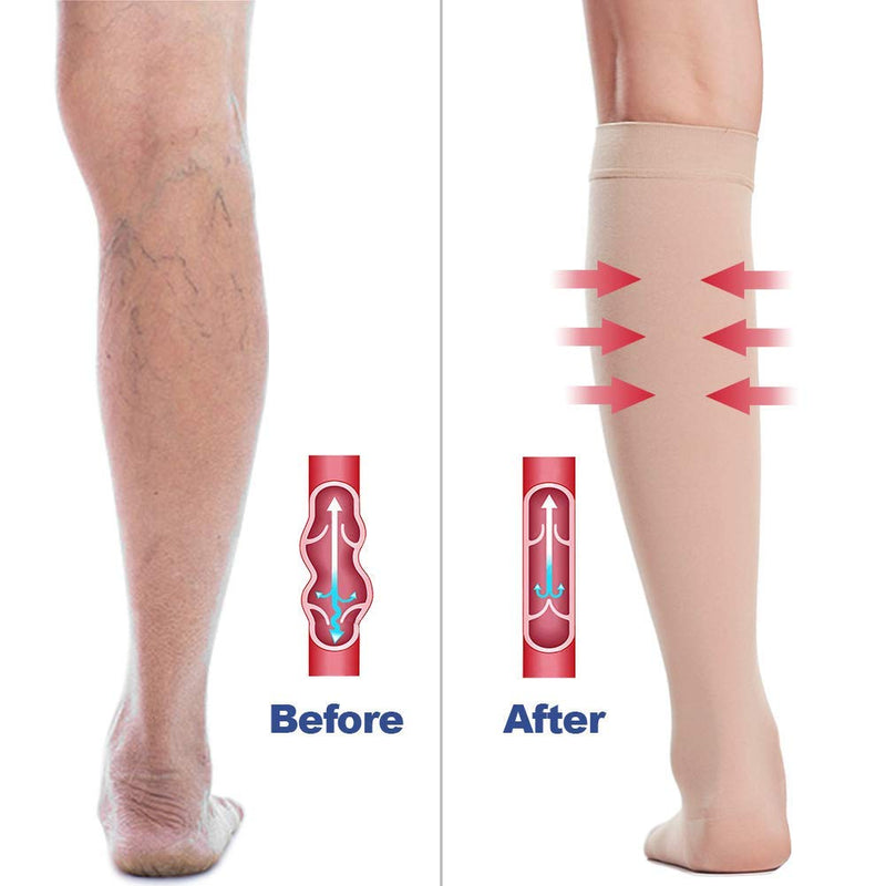 Beister Medical Open Toe Knee High Calf Compression Socks for Women & Men, Firm 20-30 mmHg Graduated Support Hosiery for Varicose Veins, Edema, Flight, Pregnancy （A Pair） Beige M - NewNest Australia