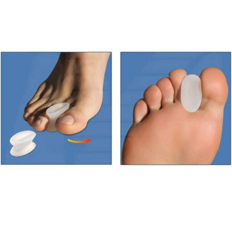 Gel Toe Caps, Hallux Valgus Toe Separator, Silicone Toe Protection, Toe Separator, Toe Corrector Spacers For Overlapping Toes, Soft And Comfortable, Pack Of 4 - NewNest Australia