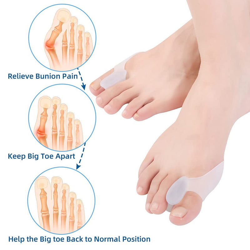 Hoogoo Bunion Corrector Toe Protectors Pads to Relax 10Pack, Silicone Toe Spacers Spreader Straightener Gel Bunion Cushions Guards for Big Toe - NewNest Australia