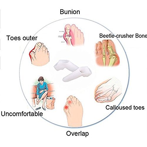 Pedimend Silicone Gel Toe Seperators with Bunion Protector (1PAIR) - Toe Straightener for Hallux Valgus - Double Loop Toe Separator - Eases Pain on Sore Bunion Joint - Avoid Shoe Friction - Foot Care - NewNest Australia