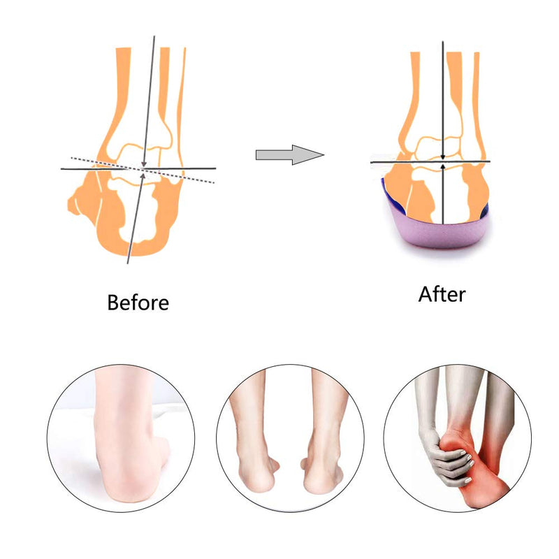 Pcssole's 3/4 Orthotics Shoe Insoles High Arch Supports Shoe Insoles for Plantar Fasciitis, Flat Feet, Over-Pronation, Relief Heel Spur Pain, Blue, L:UK-M(6-8) L:UK-M(6-8) - NewNest Australia