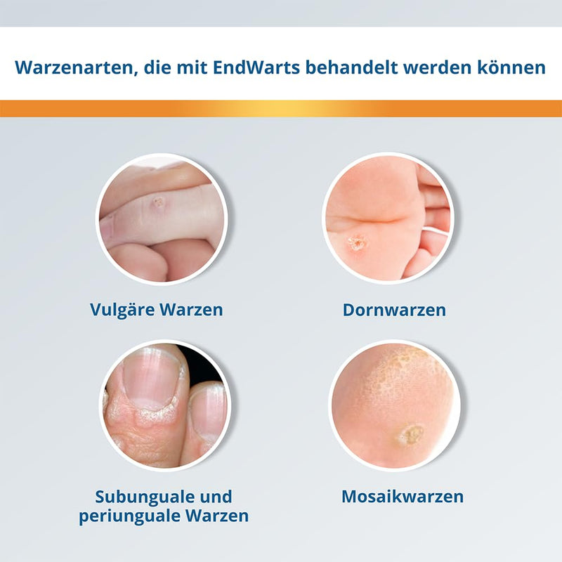 EndWarts FREEZE: Treat warts & plantar warts, icing agent for treating stalked warts on hands, arms & feet, 7 disposable tips - NewNest Australia