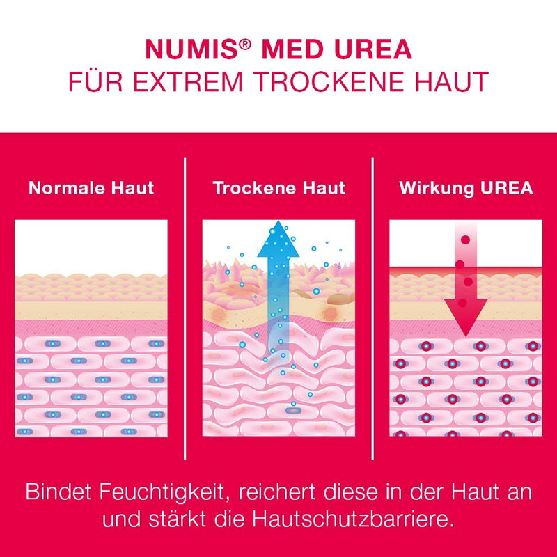 Numis Med Cracked Ointment With 25% Urea Pack Of 3 - Skin Soothing Cracked Foot Cream For Very Cracked & Highly Callused Feet - Vegan Skin Care Without Silicone & Parabens - Foot Care (3 X 50 Ml) - NewNest Australia