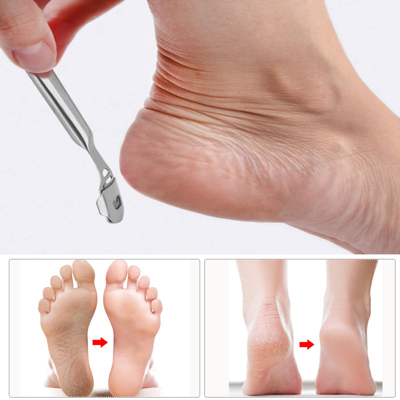 Callus Remover Foot Scraper - Stainless Steel Callus Planer Foot File Callus Rasp Hard Skin Callus Remover Foot Rasp Pedicure Foot Care Tool with 10 Replacement Blades for Wet & Dry Feet Silver - NewNest Australia