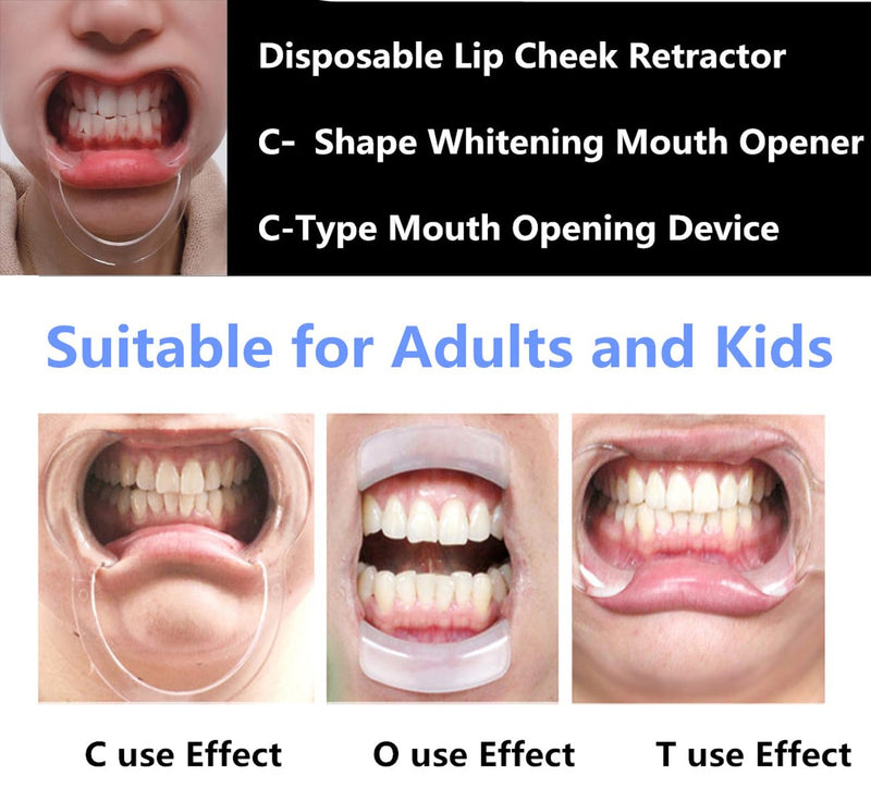 Dental Cheek Retractor, 12 Pcs C Shape Autoclavable Mouth Opener for Teeth Whitening, 3 Sizes Clear Lip Cheek Retractor for Dentist Party Mouth Guard Speak Out Challenge Game - NewNest Australia