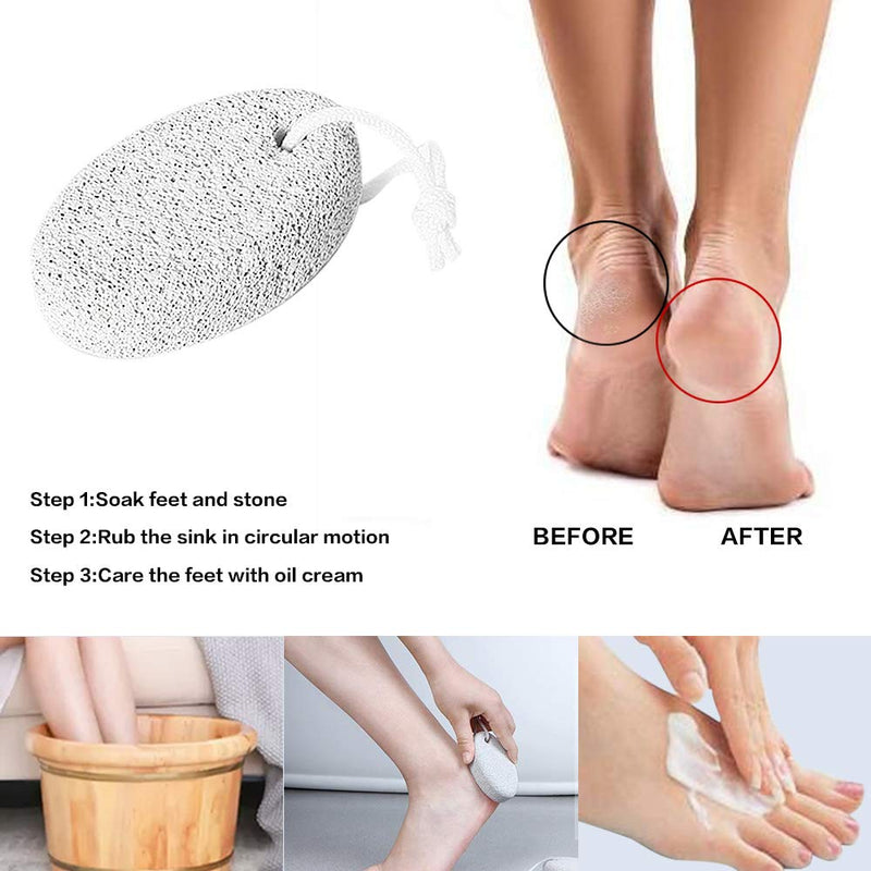 Pumice Stone 2Pcs, Natural Lava Foot File Pumice Stone for feet/Hands/Body Scrubber Hard Skin Callus Remover White - NewNest Australia