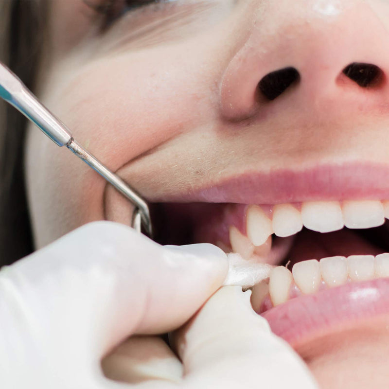 Gauze Pads 3x3, JMU 4 Ply Nonstick Gauze Pads, Non Sterile Medical Gauze Pads 200 Count All Purpose Gauze 3"x3" 200P - NewNest Australia