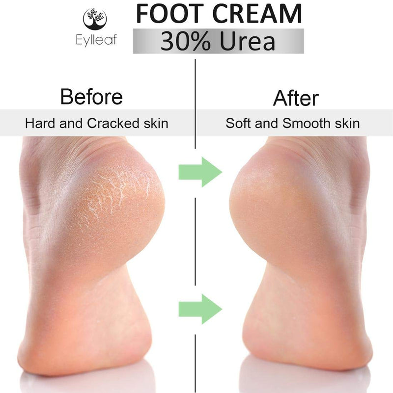 Foot Cream 30% Urea by Eylleaf - Foot Repair Treatment for Dry Feet and Cracked Heels 200ml - NewNest Australia