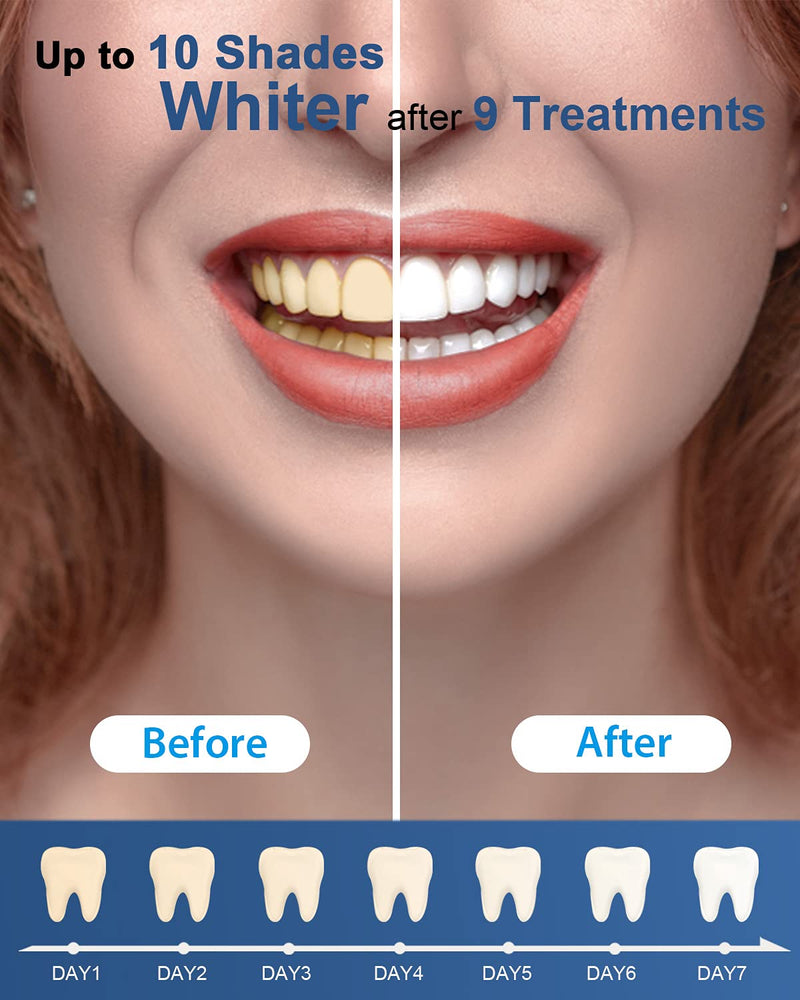 MySmile Teeth Whitening Gel Pen Refill Pack, 3 Non-Sensitive Teeth Whitening Pen, Deluxe Teeth Whitener Dental Grade Tooth Whitening Gel with Carbamide Peroxide for Home, Travel, 10 min Fast Result - NewNest Australia