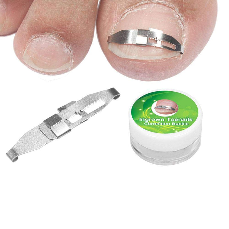 3pcs Ingrown Toenail Tools, Stainless Steel Ingrown Toenail Corrector Pain Relief Paronychia Treatment Correcting Tool for Ingrown Toe Nails Curve Correct, Correct Toes - NewNest Australia