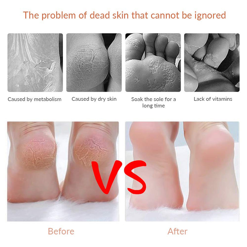 Codream Pedicure Callus Shaver Foot File Care Hard Skin Remover Callus Shaver Sets with Case, Foot File Heads & 10 Replacement Blade - NewNest Australia