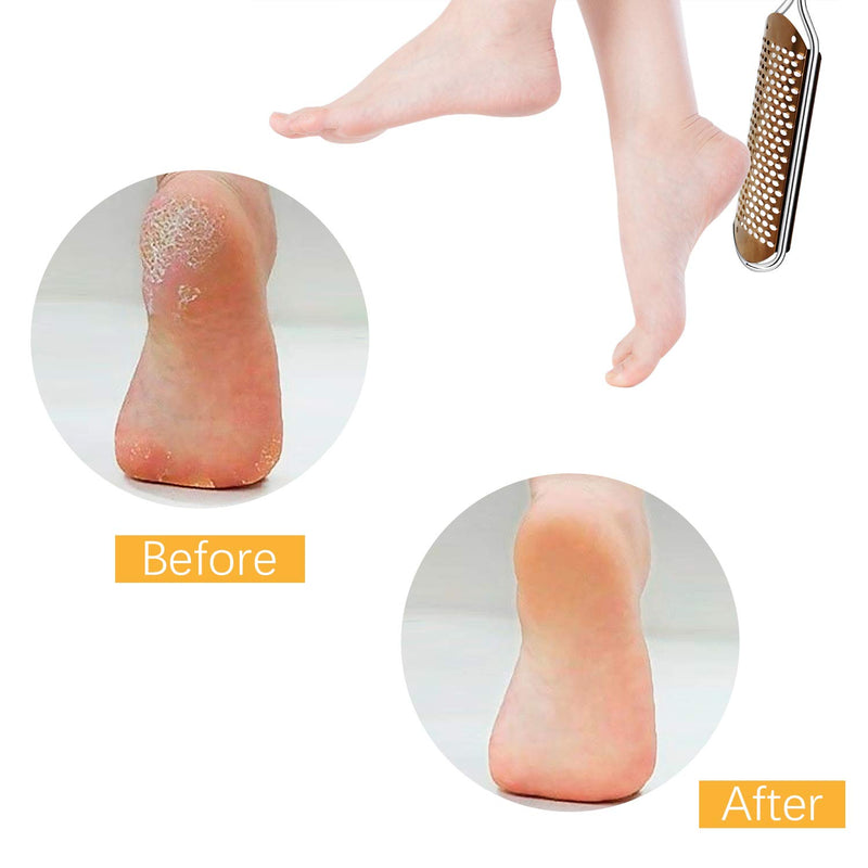 Foot File for Hard Skin Callus Remover - Large Foot Rasp Colossal Foot Scrubber Professional Stainless Steel Pedicure File for Wet and Dry Feet - NewNest Australia