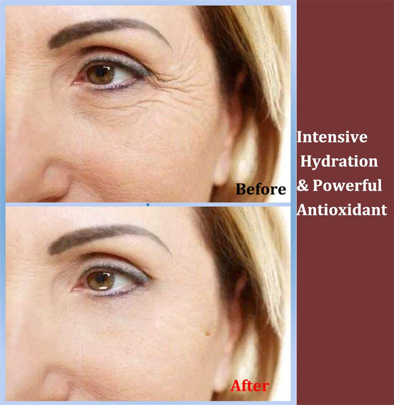 Under Eye Patches 24k Gold Under Eye Mask Puffy Eyes and Dark Circles Treatments Under Eye Bags Treatment Collagen Eye Pads for Beauty & Personal Care 29 Pairs - NewNest Australia