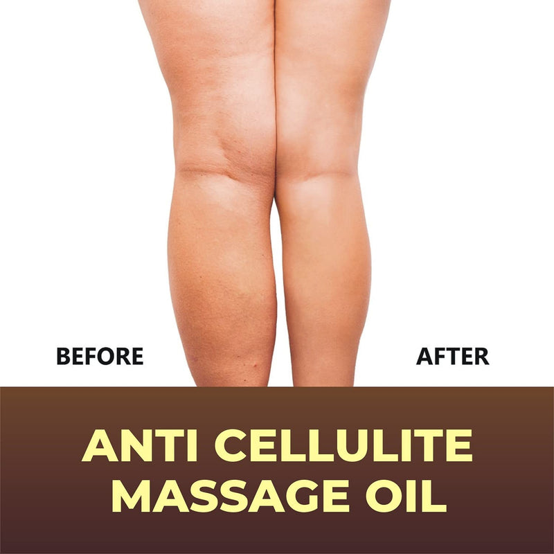 Anti Cellulite Massage Oil - Infused w/ Collagen & Stem Cell - 100% Natural Massage Lotion & Cellulite cream, Remover & Massager - Helps Skin Tightening & Stretch Mark treatment for Women & Men - 8 oz - NewNest Australia