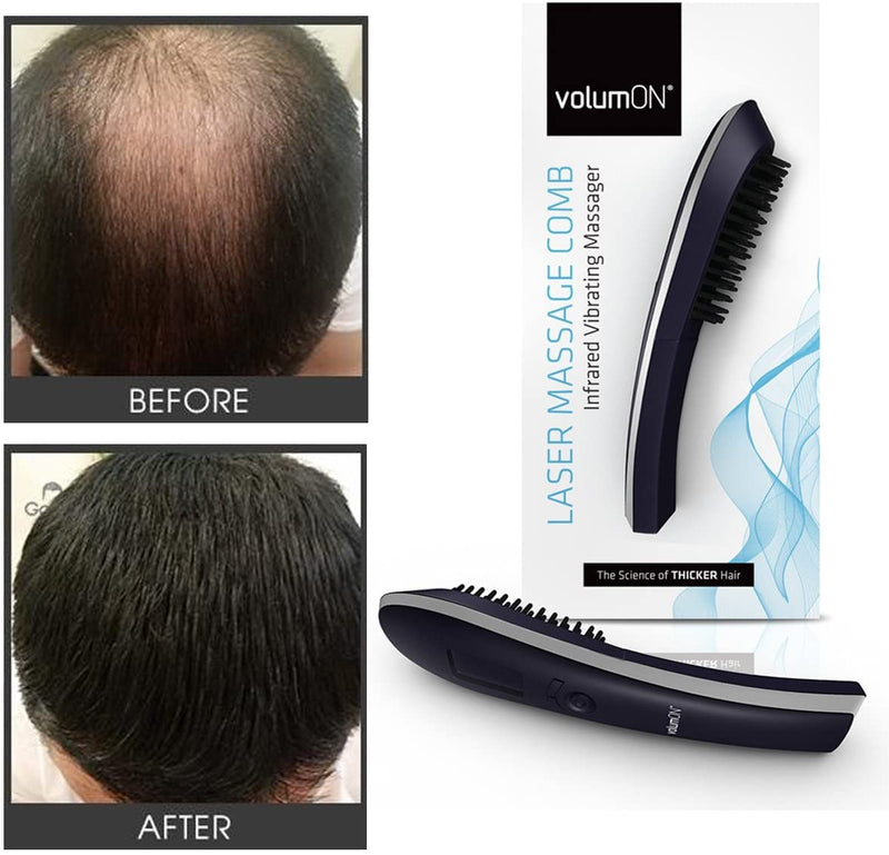 Hair Growth Brush VOLUMON® Hair Growth Treatment Laser Device to Help Prevent Further Hair Loss and Promote Hair Regrowth - Infrared Vibrating Massager with LCD Display for Men & Women - NewNest Australia