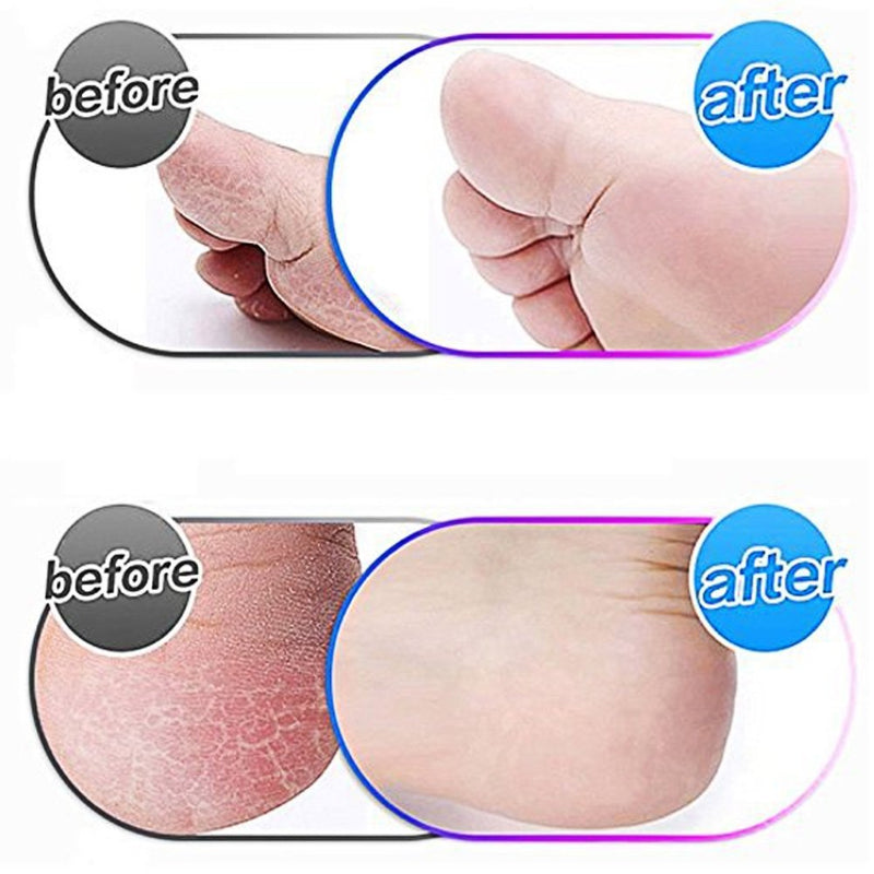 [Pack of 4] Canwn Extra Coarse Mineral Replacement Rollers for Scholl Velvet Smooth Callus Remover Refill Rollers with Diamond Particles Black - NewNest Australia
