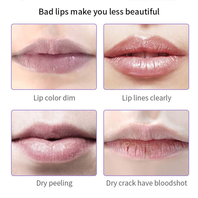 2PCS Lip Mask Overnight, Honey&Sakura Day and Night Repair Lip Sleeping Masks Honey Lip Balm, Fade Lip Lines Bee Balm Lip Balm, Hydrating &Prevention Dry and Crack Lip Scrubs Exfoliator - NewNest Australia