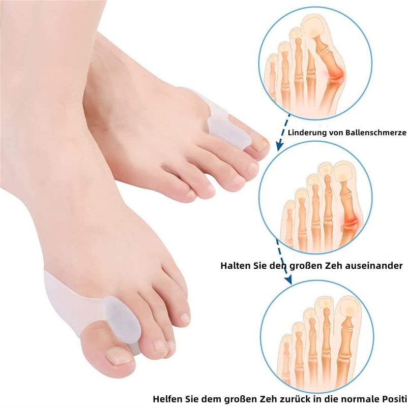 Gel Large Toe Separator Bunion Protector Pain Relief For Crooked Hallux Valgus Overlapping Toes Pressure Protection Corrector Shield Pad Separator Cushion 6 Pack - NewNest Australia