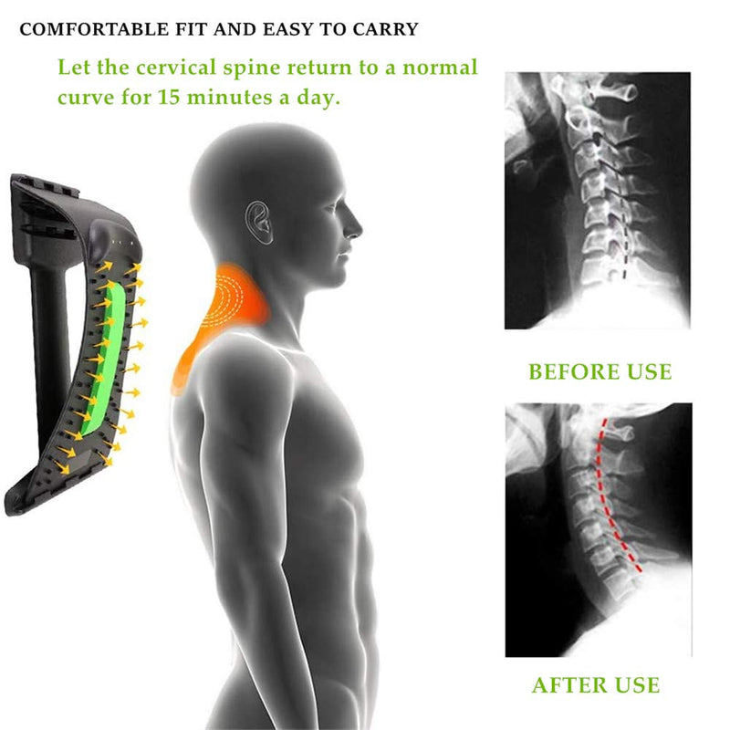 Ygmxzl Back Stretcher For Posture Correction, Neck And Shoulders Relaxer, Traction Cushion, Head And Neck Massager For Posture Correction And Back Pain Relief - NewNest Australia