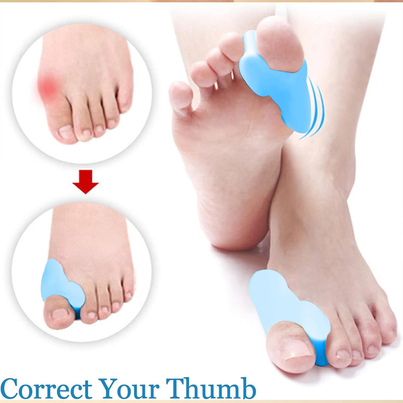 Toe Separator Silicone, Hallux Valgus Toe Separators, 4 Pairs Light Blue Toe Separators, Silicone, For Overlapping Toes, Reduced Foot Pain Friction, Toe Straightener For Men And Women (Light Blue) - NewNest Australia