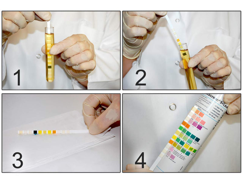 Analyticon - Combi Screen 11Sys, Plus, Urine Strip Test, Visual Examination Or Use With Urilyzer 100, 100 Pro, 500 Pro And Combiscan 100, 11 Parameters, Pack Of 100 Strips - NewNest Australia