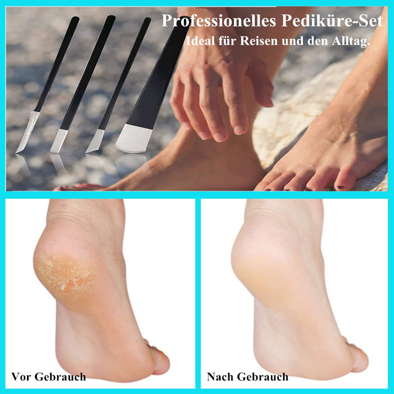 Pack Of 4 Pedicure Knife Kits, Professional Callus Slicer Blades Made Of Stainless Steel Callus Remover, Pedicure Knife Dead Skin Corn Foot File Rasp For Pedicure Foot Care Tools - NewNest Australia