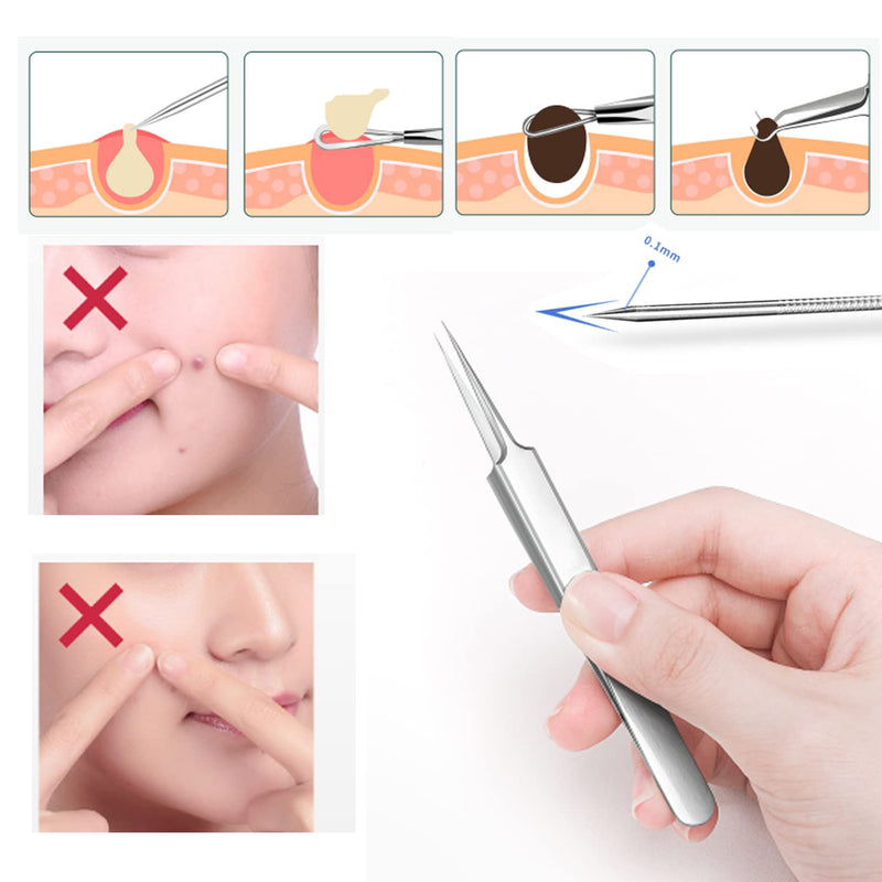 6 Pieces Blackhead Remover Tool Kit, Stainless Steel Comedone Extractor Tweezers Acne Needle Blemish Whitehead Removal Pimple Zit Spot Popper Patches for Nose Face Skin - NewNest Australia