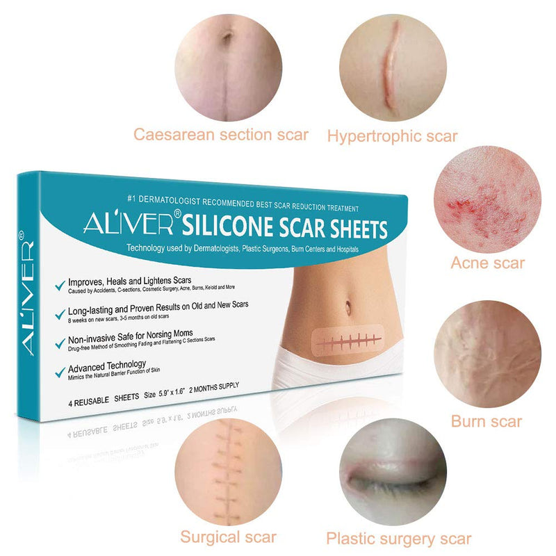 Silicone Scar Removal Sheets Fast & Effectively Removes Scars For C Sections, Acne, Surgery, Burns And More Reusable Scar Strips [15 X 4Cm] - 4 Pack (2 Month Supply) - NewNest Australia