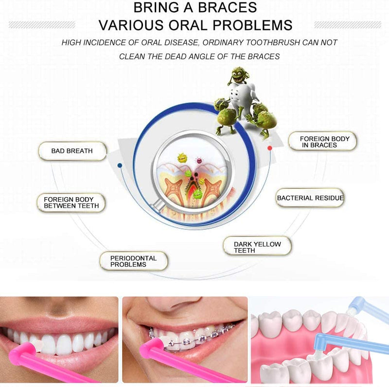 Maq 12 Pieces Manual Interspace Toothbrush For Orthodontic Braces And Bridges, Soft Slim Tufted Toothbrush, Bpa Free Toothbrushes For Hard To Reach Areas, Deep - NewNest Australia