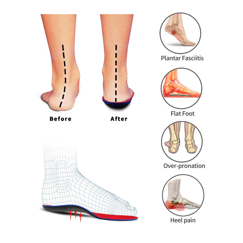 PCSsole Orthotic Arch Support Shoe Inserts Insoles for Flat Feet,Feet Pain,Plantar Fasciitis,Insoles for Men and Women Men6/Women(5.5-6)25cm A-red - NewNest Australia