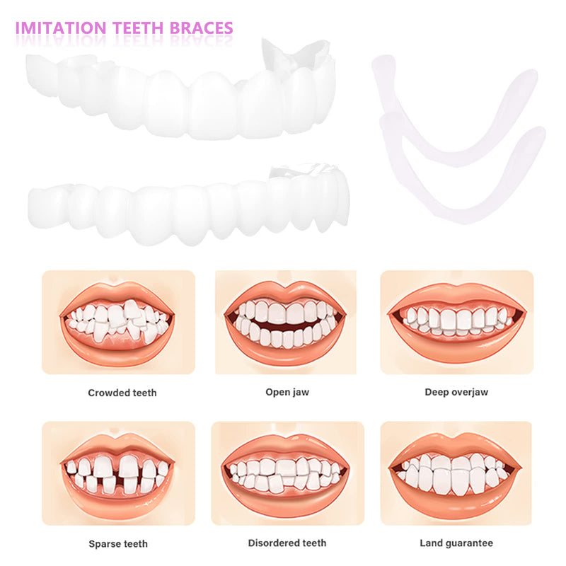 2 Pairs Instant Veneers Dentures, Cosmetic Veneers Teeth Temporary Dentures Fake Teeth Smile Teeth Veneers Top and Bottom Snap On Dentures Clip in Veneers Teeth for Men Women with Bad Teeth - NewNest Australia