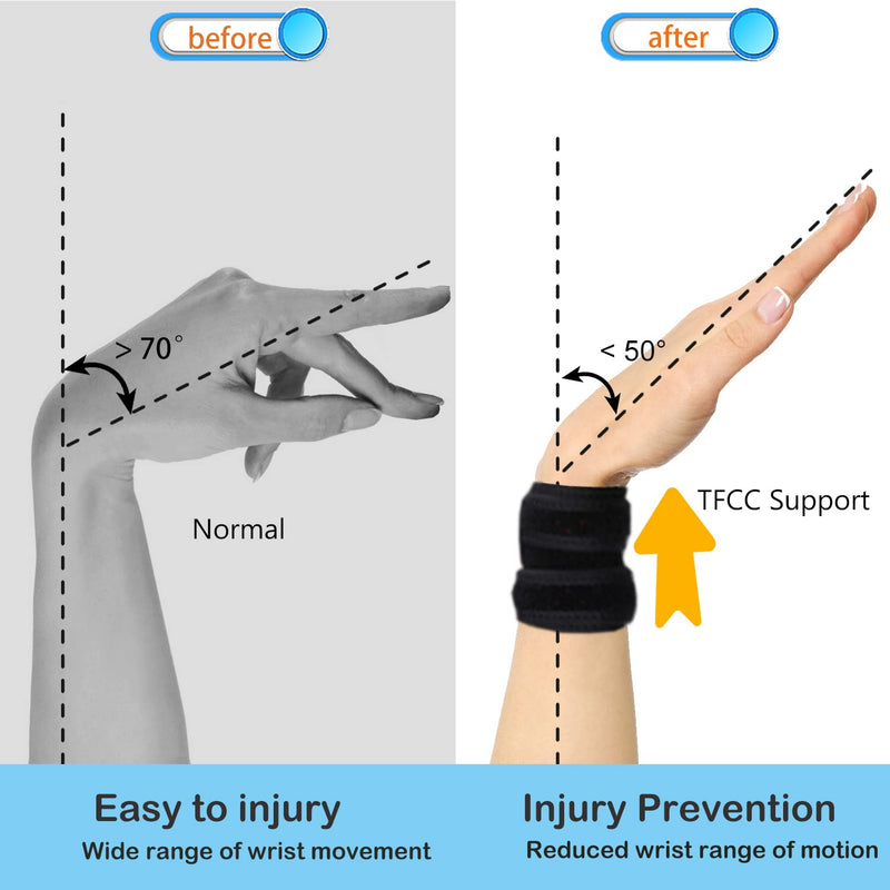 VerteLife Wrist Support for TFCC Tear Wrist Brace Wrist Compression Strap Wrist Band for Tendonitis Pain Relief, Sports Protecting, Fitness 1 Pair - NewNest Australia