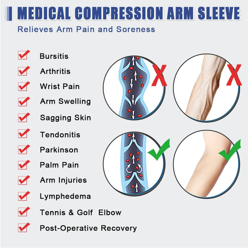Beister Lymphedema Medical Compression Arm Sleeve Women & Men (Pack Of 1), 20-30 Mmhg Compression Sleeves, Palm & Wrist & Arm Support, Elbow Brace, Arm Support For Arthritis, Tennis Elbow - NewNest Australia