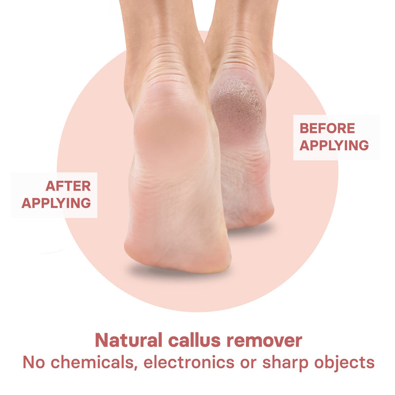 VALNEO Foot File for Hardened or Dry Skin - Coarse and Fine Callus File Made of Rosewood Wood - Wooden Paddle Callus Remover for Hand and Foot Rose Wood - NewNest Australia