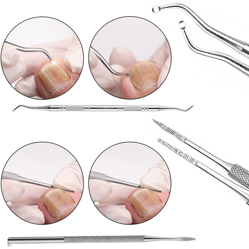 Pedicure Callus Razor Set, Callus Slicer, Foot File, Callus Remover, Feet, Stainless Steel Foot Rasp, Hard Skin Heel, Callus Removal For Hand Feet Foot Care With 10 Replacement Blades - NewNest Australia